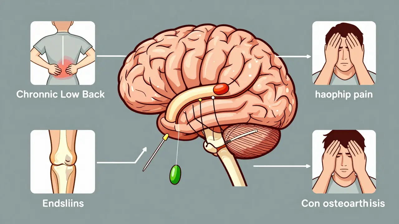 A scientific illustration of the nervous system responding to acupuncture with neurotransmitter pathways and pain condition icons.